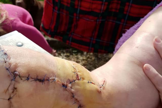 Police have dropped the case but Rachel can’t work and is still receiving treatment for her injuries, and unable to use her right hand properly