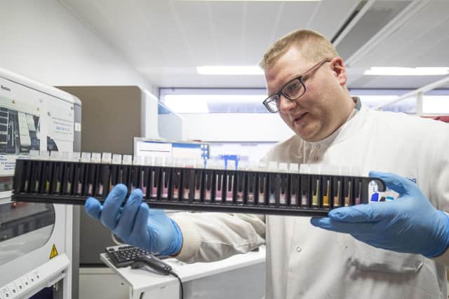 Clinical support technician Douglas Condie extracts viruses from swab samples so that the genetic structure of a virus can be analysed and identified in the coronavirus testing laboratory at Glasgow Royal Infirmary, Glasgow.