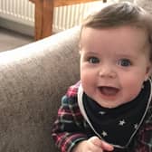 Ralph Gibbs, who will be nine months old this week, is now a thriving and happy boy after undergoing treatment for a rare benign tumour of blood vessels.