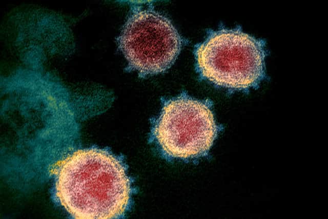 Should China issue an apology to the world over coronavirus?