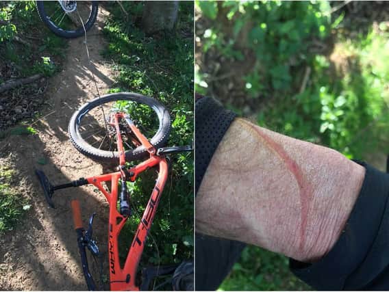 A man has been injured after a thick, metal wire was deliberately placed across a woodland path in Leeds. Photo: West Yorkshire Police.
