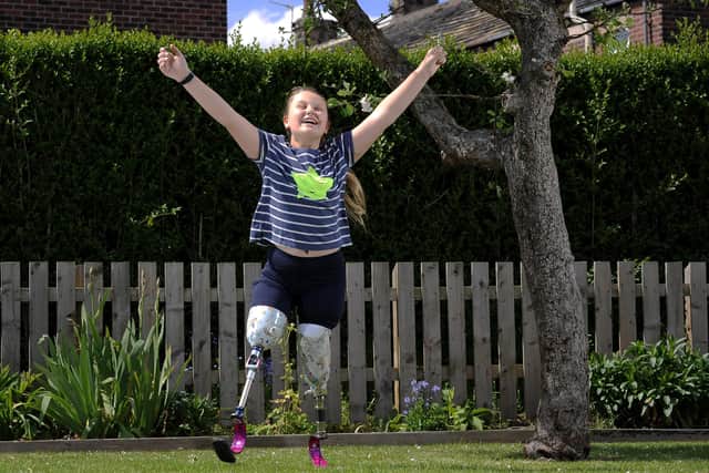 Maisie Catt nwated to raise £260 for LimbPower - she has raised nearly £10,000..Picture by Simon Hulme