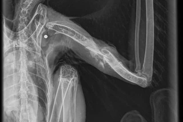 X-ray of the buzzard found shot near Kirkby Malzeard in North Yorkshire