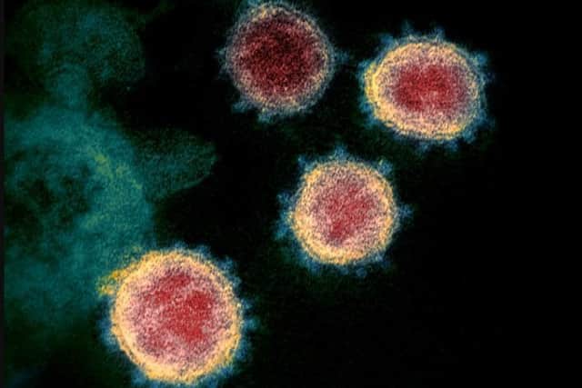 An undated electron microscope image made available by the U.S. National Institutes of Health in February 2020 showing the coronavirus that causes Covid-19