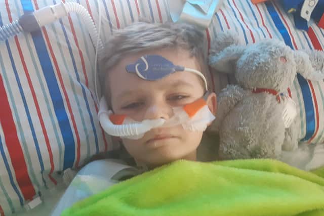 Luke was in intensive care at Sheffield Children's Hosptial and spent five months having 23 operations before being allowed home
