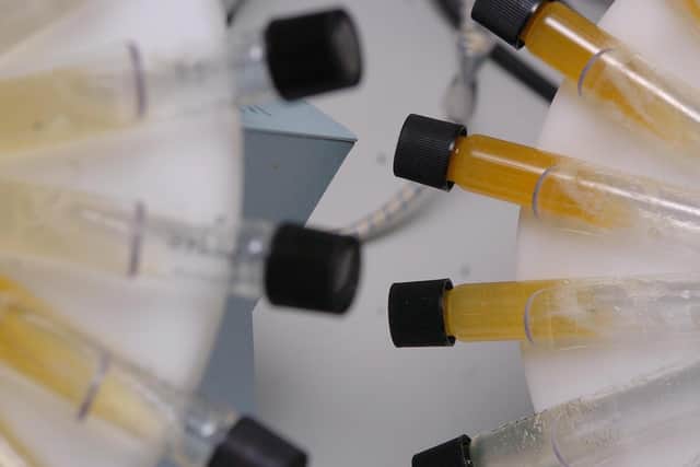 Pictured, urine samples taken from athletes or sports competitors have a liquid to liquid extraction process carried out on them. Photo credit Johnny Green/PA Wire.