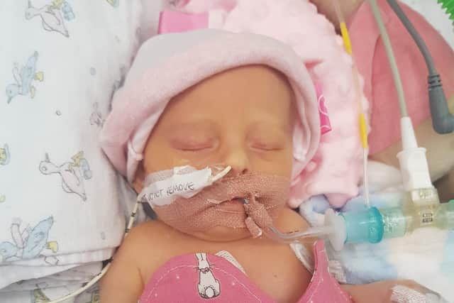 Ada was just 24 hours old when she had her first operation at Sheffield Children's Hospital