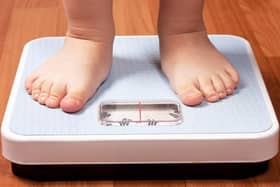 Health issue: Childhood obesity rates