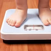 Almost half of all health and social workers questioned by academics at a Yorkshire university have indicated that they feel childhood obesity should be considered a child protection issue.