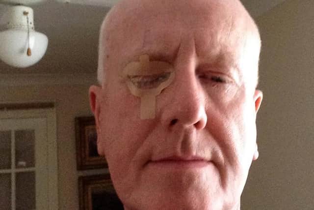 Adrian Fletcher's eyesight had been deteriorting for six years