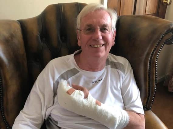 Len Hall, 70, chopped through his finger with an electric saw doing DIY during lockdown