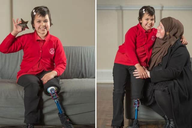 Anneeka is getting used to using her prosthetic leg and can even do the split. Picture Richard Walker/ImageNorth