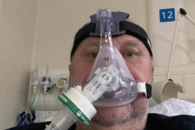 Jeff Baker wearing the CPAP mask while in hospital