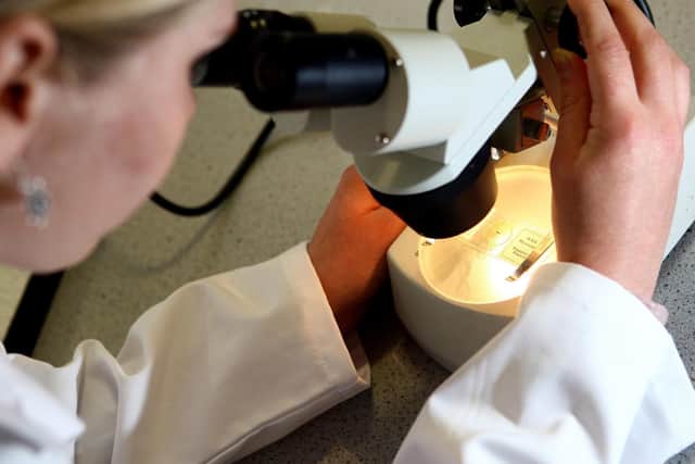 Almost all (99.8%) of cervical cancer cases are preventable, according to Cancer Research UK