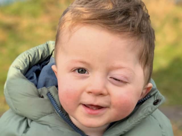 Brave Roux Owen, who is now 18 months old, had to undergo ten operations in just 11 months