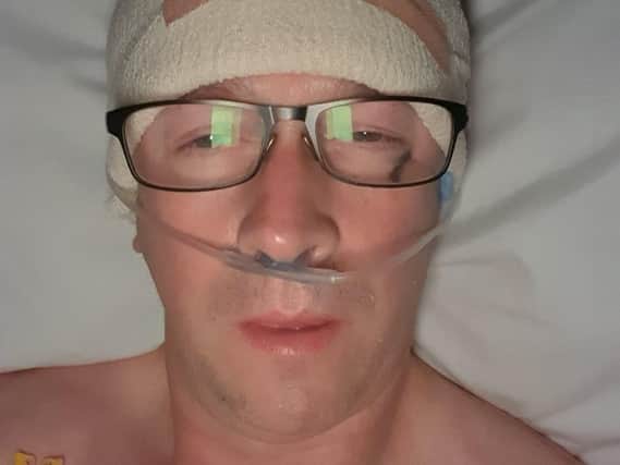 Steve Ryder underwent seven-hour surgery to remove brain tumours discovered after he collapsed during a bike ride