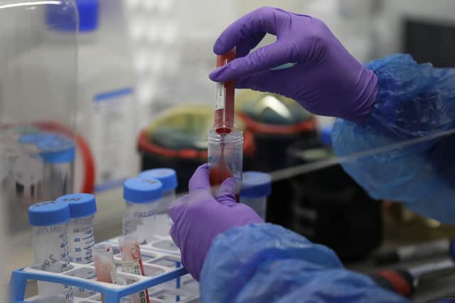 Three state-of-the-art gene therapy innovation hubs are being set up across England aimed at ensuring cutting-edge innovation is translated into transformative treatments which offer hope to millions with life-threatening diseases. Photo credit: Getty Images