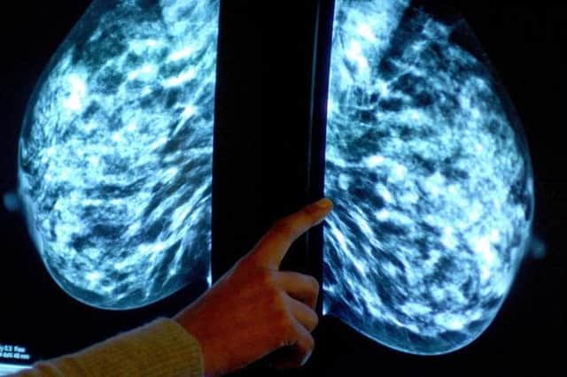60,000 fewer mammograms took place in Yorkshire during the first year of the coronavirus pandemic  Picture Rui Vieira/ PA Archive/PA Images