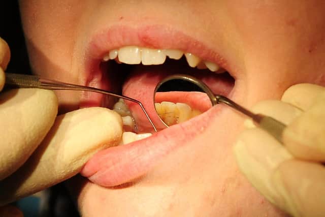 Children are waiting in "acute pain" for years to get a dental appointment, a Yorkshire MP has said.