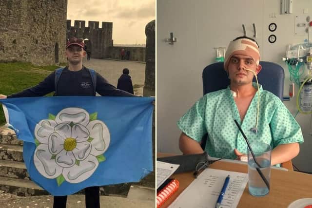 Ned Hilton, 22, was diagnosed with a life-changing brain tumour