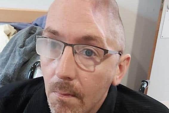 Jamie Kelly, aged 41, had half his skull removed to treat a bleed on the brain following an incident in Scarborough where he was punched by Daniel Johnson and fell to the floor and hit his head.