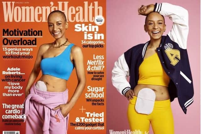 Adele Roberts is on the cover of Women’s Health with her stoma bag. Pictures: Women's Health UK/PA/ Zoe McConnell