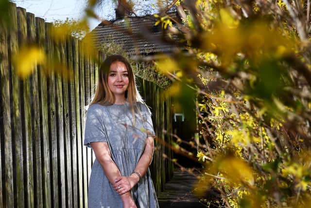 Megan Fitzmaurice pictured at her home at Eastmoor, Wakefield. Photo: Simon Hulme