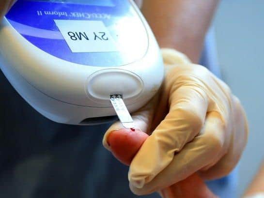 Pictured, a person is tested for diabetes. Despite having one of the youngest populations in the UK, Bradford has the highest ratio of diabetes, according to experts. Photo credit: Stock image