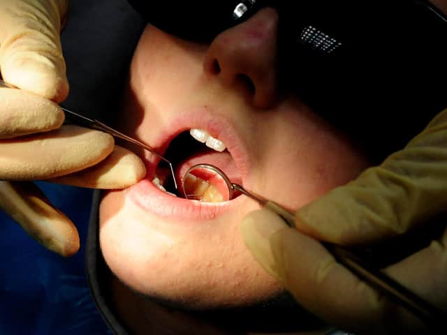 A new report has revealed inequalities in dentistry services. Picture: PA.