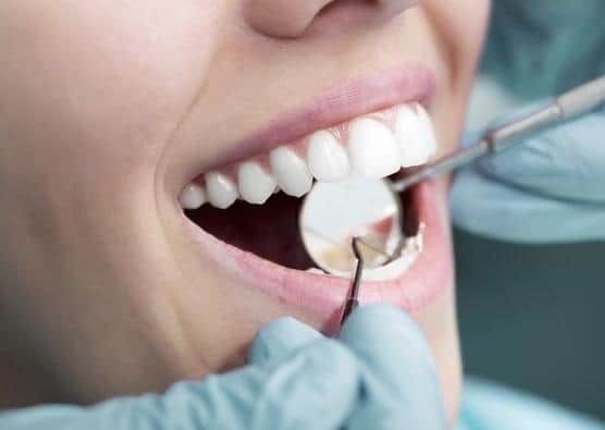 Waiting lists at some dental surgeries are said to be in excess of three years.