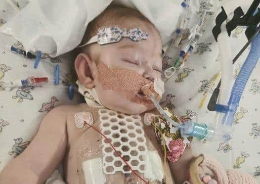 Hope was born with multiple heart problems and spent more than three months in hospital and had numerous operations