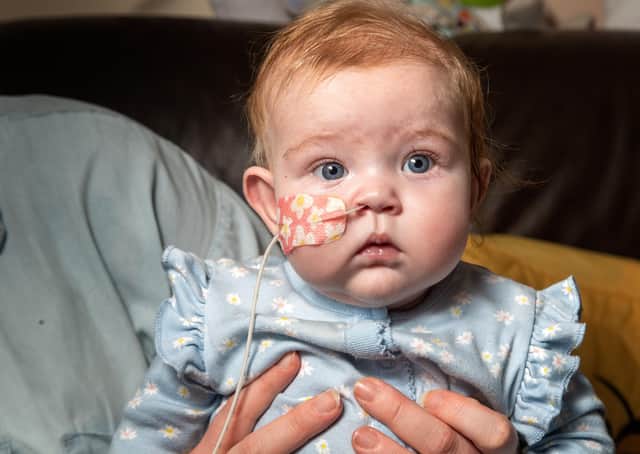 Six-month-old Hope Pickersgill has spent most of her life in hospital battling multiple congenital heart defects and other conditions..  Picture Bruce Rollinson