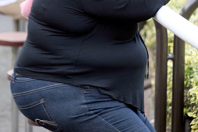 The Government's plans to tackle obesity will penalise the poor, argues Jason Reed.