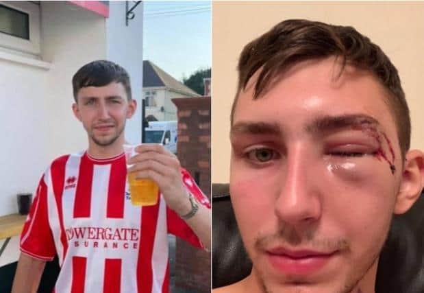 Brad Scarrott suffered horrific injuries after being attacked with a baseball bat
