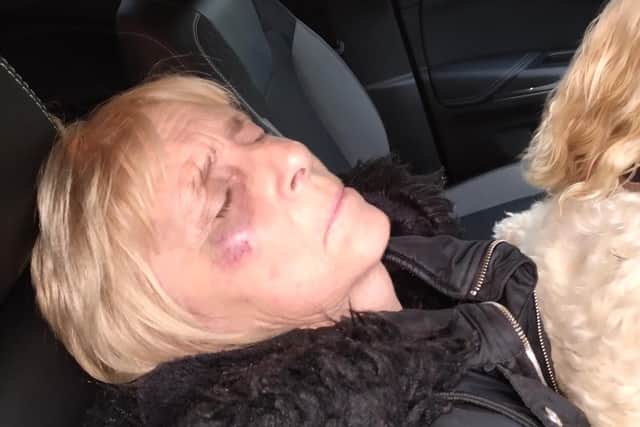 Coun Pauline Markham was taken to hospital after being attacked while walking her dog