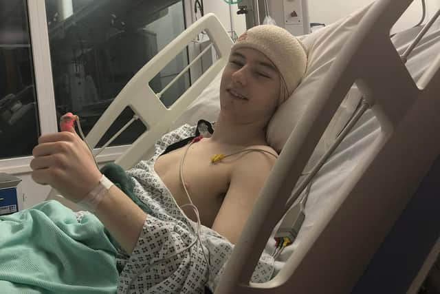 Jake under went six hours of surgery to remove a brain tumour