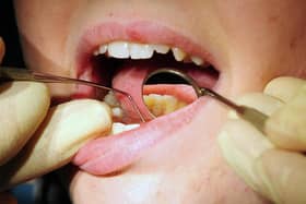 A file photo of a dentist at work. PIC: Rui Vieira/PA Wire