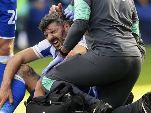 GIVING BLOOD: Sheffield Wednesday's Callum Paterson is patched up