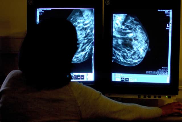 A consultant studying a mammogram of a woman's breast. Photo: Rui Vieira/PA Wire