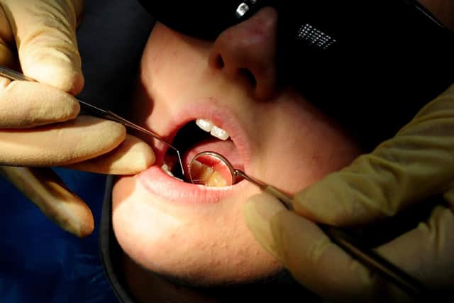 File photo of a dentist at work. Press Association