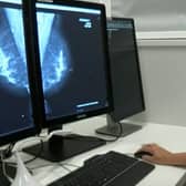 Artificial intelligence (AI) being used to support breast screening.