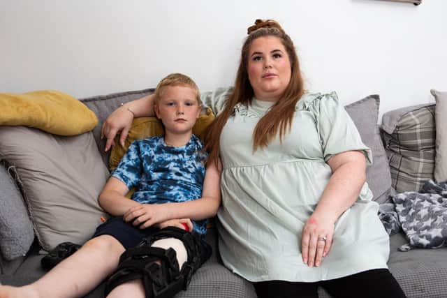 Logan Midgley has needed major surgery on his leg after knee-sliding onto a huge shard of glass at Akroyd Park in Boothtown. Pictured with his mother Becki Roberts.