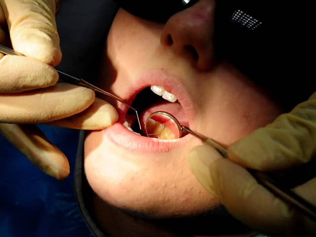 A dentist carrying out a check up on a patient. PIC: Rui Vieira/PA Wire