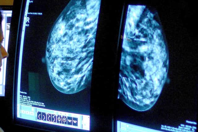 A consultant analysing a mammogram. PIC: Rui Vieira/Press Association