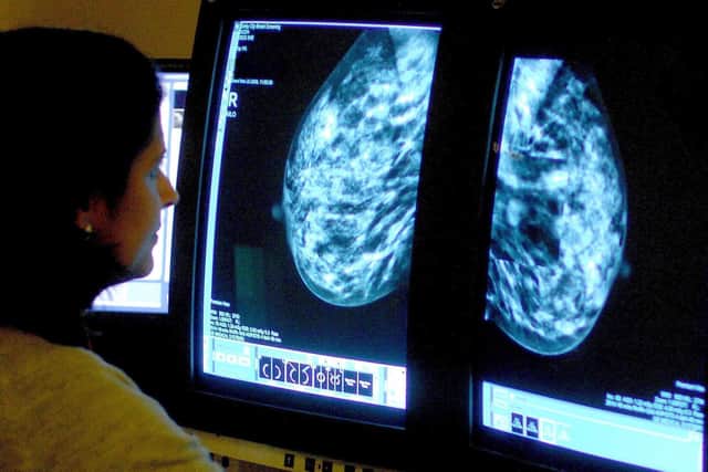 A consultant analysing a mammogram. PIC: Rui Vieira/PA Wire