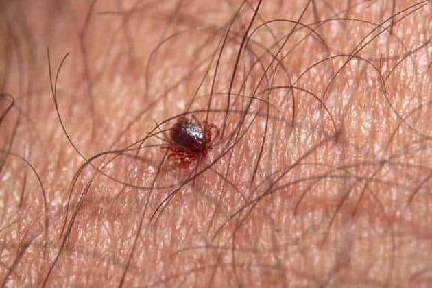 A tick on someone's arm. (Pic credit: NHS)