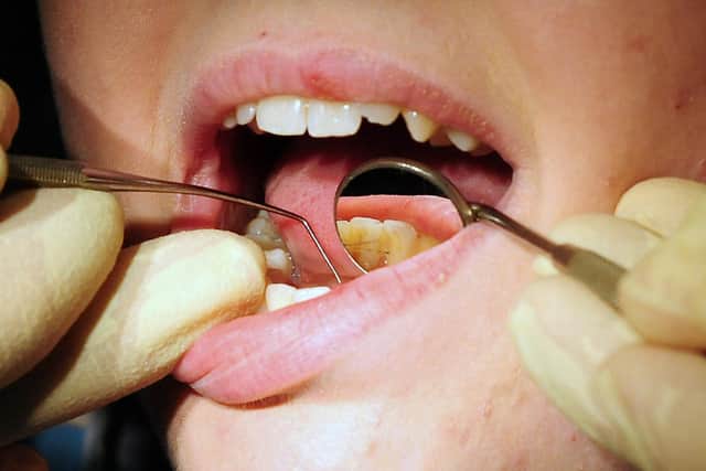 A dentist examines a patient at a surgery. PIC: Rui Vieira/PA Wire