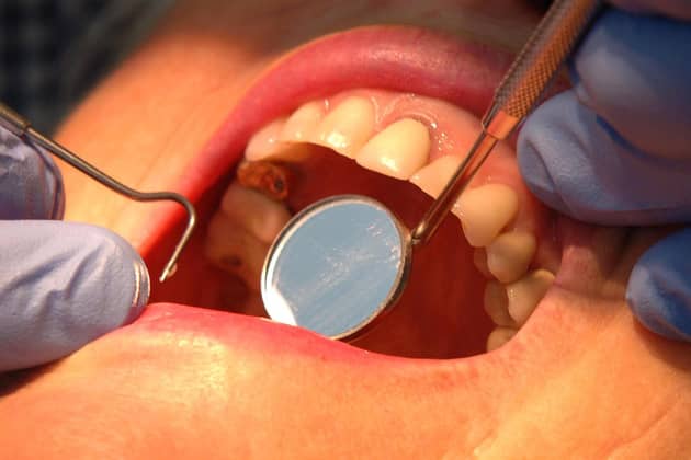 A dentist examining a patient's teeth. PIC: PA