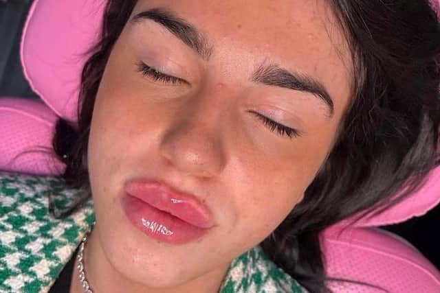 She paid £100 to have it injected in her mum's living room - and soon became obsessed with her looks. Picture: Maisie-Jane Southwell / SWNS