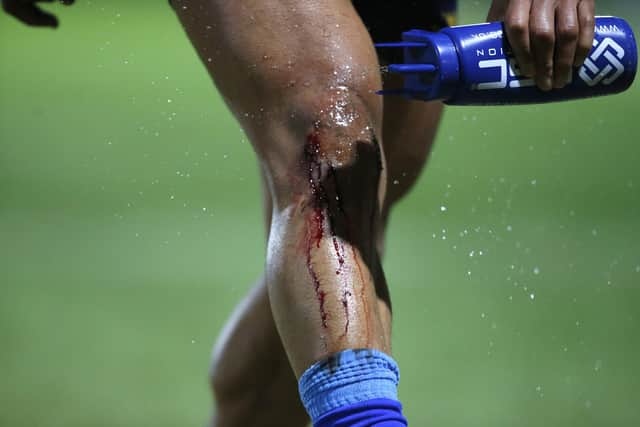 Jorge Taufua pours water on an injury as he leaves the pitch at half-time. (Photo: Ed Sykes/SWpix.com)
